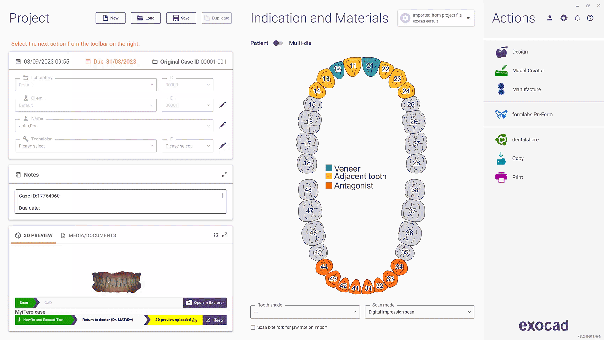 Exocad DentalCAD Elefsina 3.2