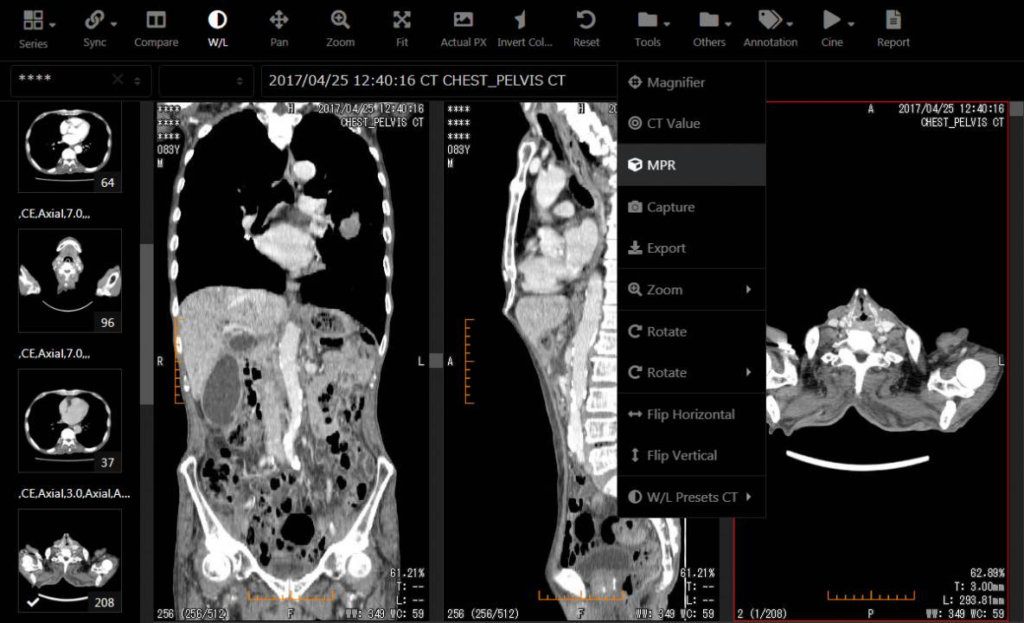 SonicDICOM PACS 3.16